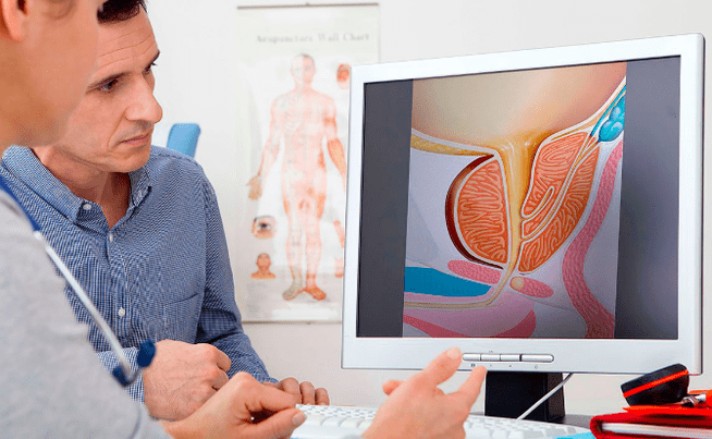 Diagnose von Prostatitis